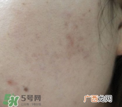 屈臣氏白金系列有问题_曝光