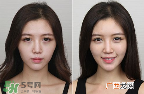 苹果肌怎么化？苹果肌究竟哪里好？