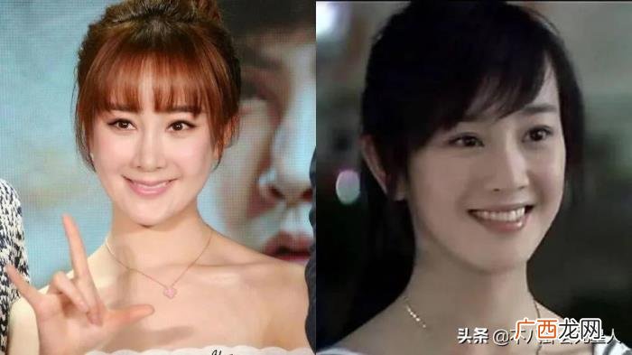 整容后遗症明星，整容后遗症