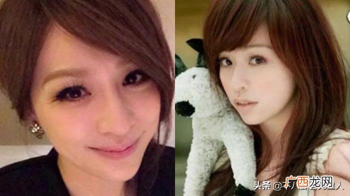 整容后遗症明星，整容后遗症