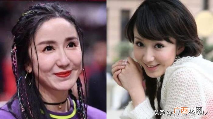 整容后遗症明星，整容后遗症