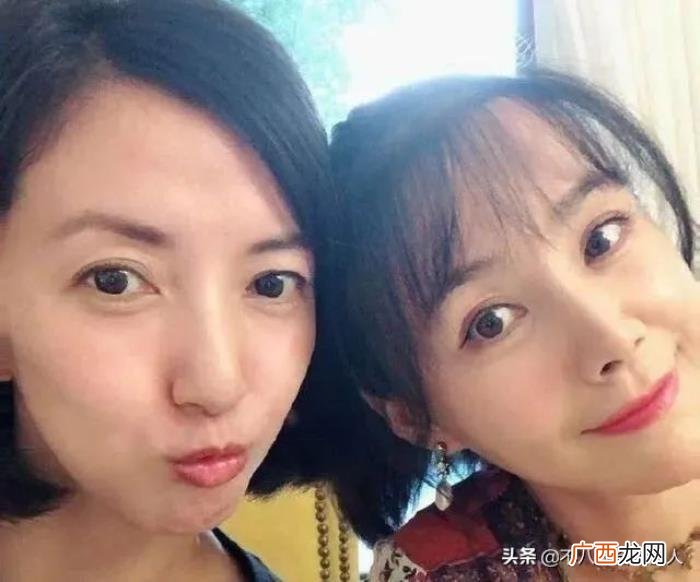 整容后遗症明星，整容后遗症