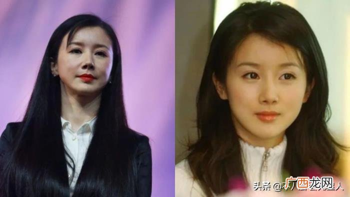整容后遗症明星，整容后遗症