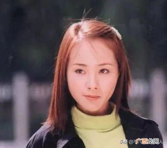 整容后遗症明星，整容后遗症