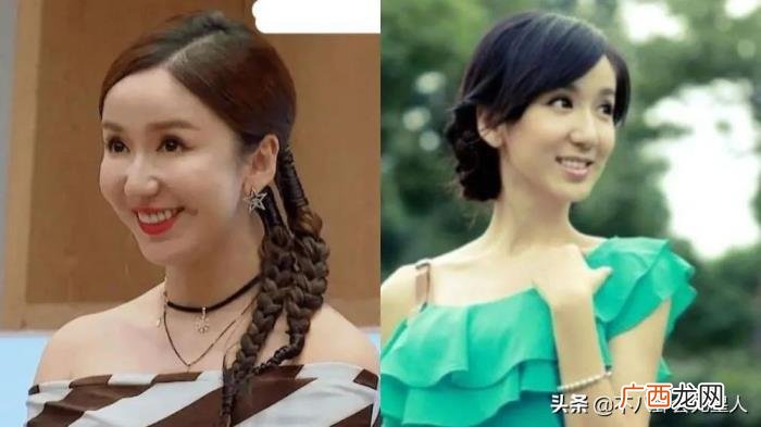 整容后遗症明星，整容后遗症