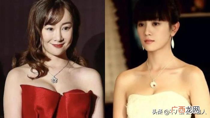 整容后遗症明星，整容后遗症
