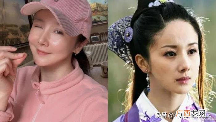 整容后遗症明星，整容后遗症