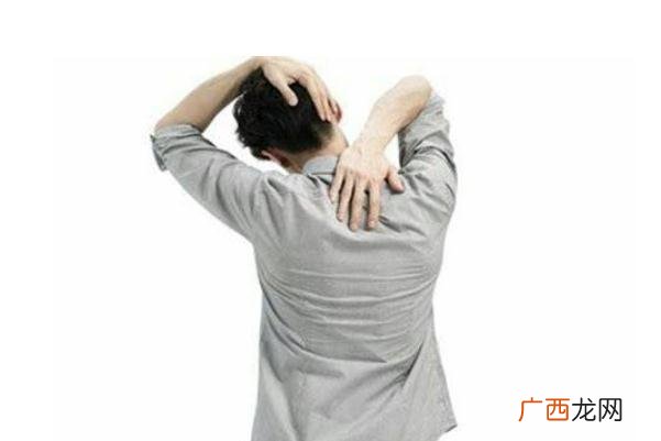 落枕吃什么药好得快落枕是什么感觉