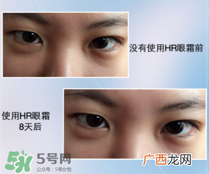 赫莲娜小绿宝瓶急救眼霜好用吗 使用感受