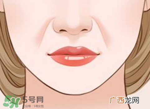 法令纹怎么消除?如何正确对待法令纹?