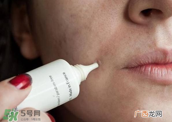 痤疮的分类 痤疮的护理原则