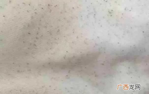 白色衣服有黑色斑点怎么洗净？不用漂白水就可以清理干净！