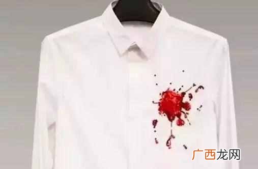 白色衣服有黑色斑点怎么洗净？不用漂白水就可以清理干净！