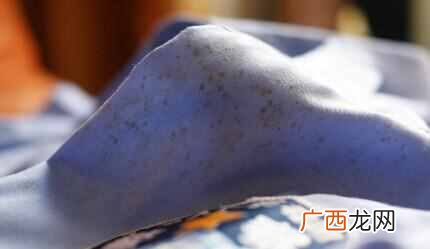 如何去衣服上的霉点？生活小妙招：去除衣服上霉点的妙招