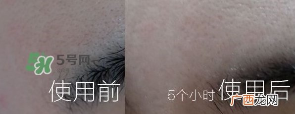 derm institute得因特是什么牌子_哪国的_什么档次