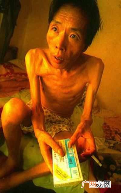 吸毒者初期的症状？三大症状让你不得不重视