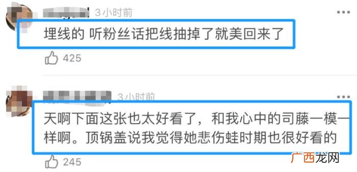 景甜大双眼皮是埋线么，32岁景甜双眼皮埋线拆了