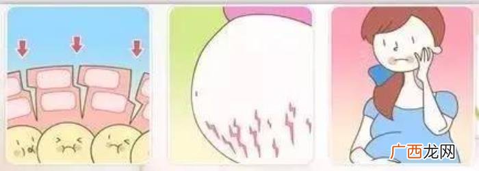 怎样修复肚子上的妊娠纹，妊娠纹有效修复方法介绍
