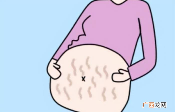 怎样修复肚子上的妊娠纹，妊娠纹有效修复方法介绍