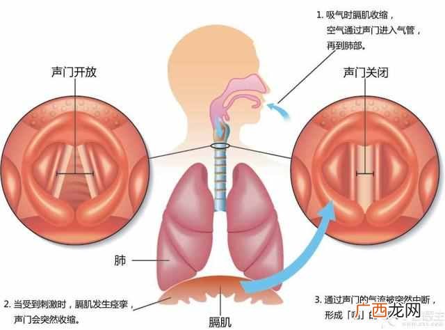 老是打嗝是怎么回事？经常打嗝到底是咋回事？