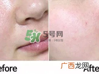 homefacialpro蜂胶面膜怎么样_hfp蜂胶面膜好用吗