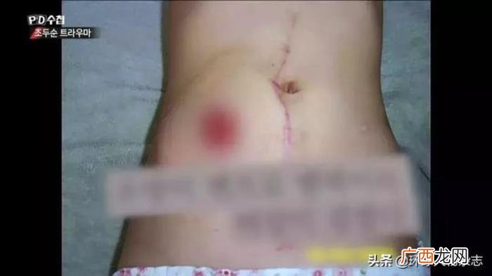 素媛案件真实女孩怎么样了，素媛真实原型现状怎么样了