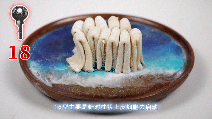 HPV 侵 害 宫 颈 全 过 程 曝 光 | 实物模拟