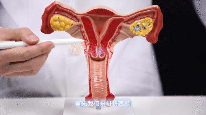 HPV 侵 害 宫 颈 全 过 程 曝 光 | 实物模拟