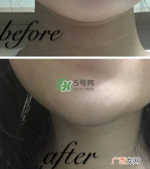 olay小白瓶有哪些版本？olay小白瓶版本区别