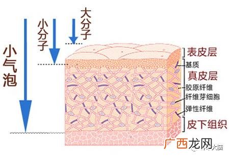 小气泡是什么 小气泡去黑头有效吗