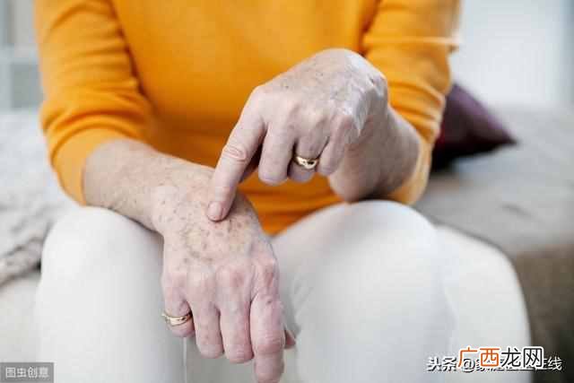 如何去掉脸上老年斑？什么方法能淡化老年斑？