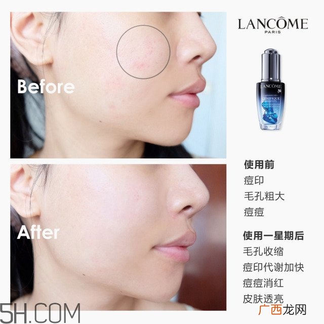 兰蔻小黑瓶安瓶精华多少钱_兰蔻小黑瓶安瓶版专柜价格