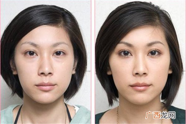 眼袋发黑怎么办去眼袋的方法