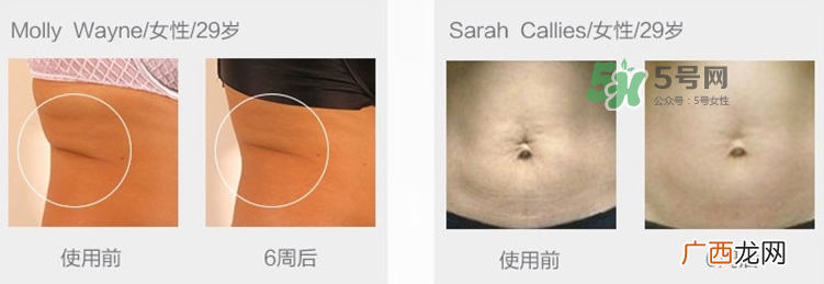 tripollar怎么样 tripollar怎么用