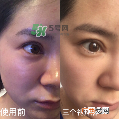 tripollar怎么样 tripollar怎么用