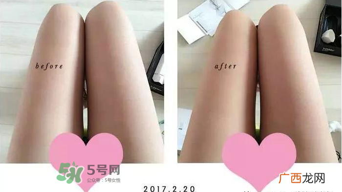 tripollar怎么样 tripollar怎么用