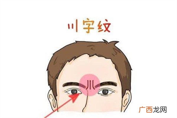 川字纹形成的原因是什么原因是这样