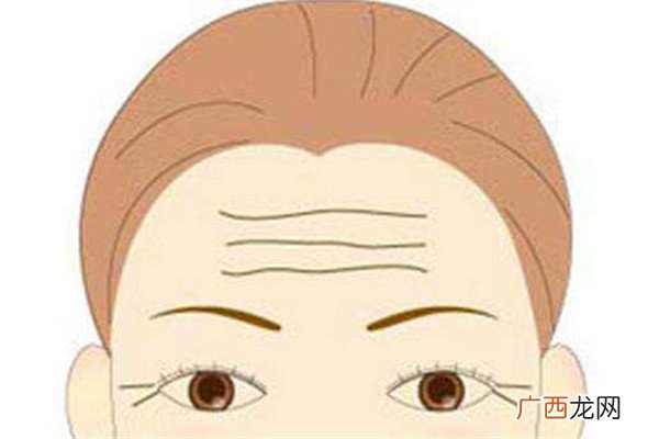 怎样去掉抬头纹去掉抬头纹的方法
