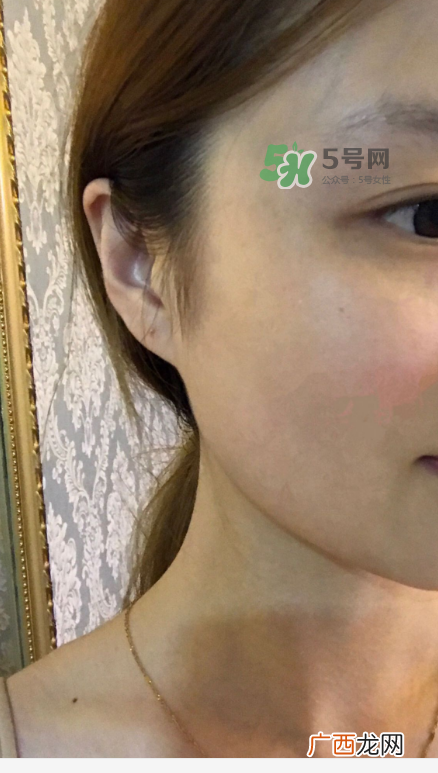 一清堂清痘调理水价格 一清堂清痘调理水有用吗？