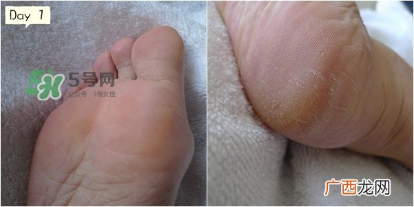 baby foot足膜怎么用？baby foot足膜使用方法