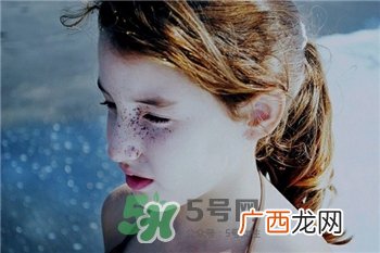 晒斑和雀斑是一样的吗?晒斑和雀斑的区别