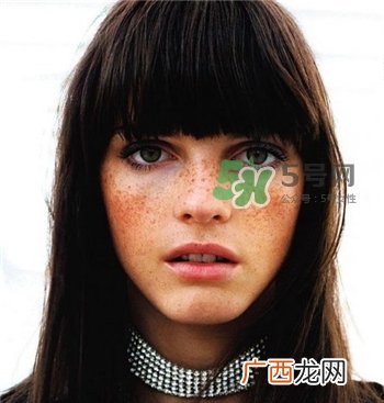 雀斑为什么越来越多?促使雀斑越来越多的原因