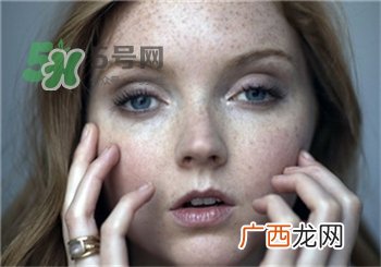 雀斑为什么越来越多?促使雀斑越来越多的原因