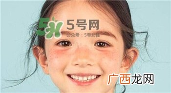 雀斑为什么越来越多?促使雀斑越来越多的原因