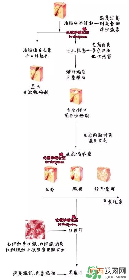 祛红色痘印用什么药膏 各色痘印祛除方法