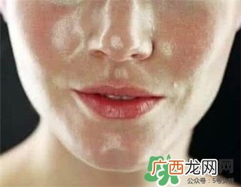 怎么样通过饮食改善油性皮肤?油性皮肤的食物