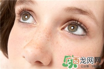 黄褐斑能彻底去除吗?黄褐斑怎么祛除?