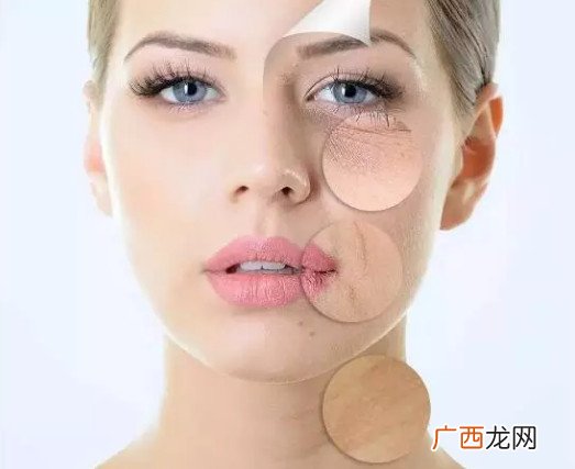 用眼霜会长脂肪粒吗 擦眼霜会长脂肪粒吗