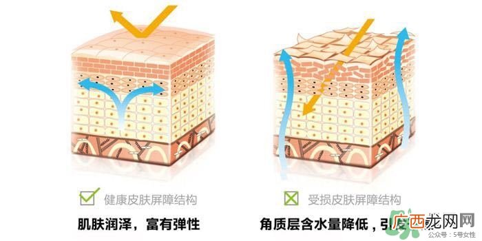 敏感肌脸颊发红怎么办 后天型敏感肌是怎么形成的
