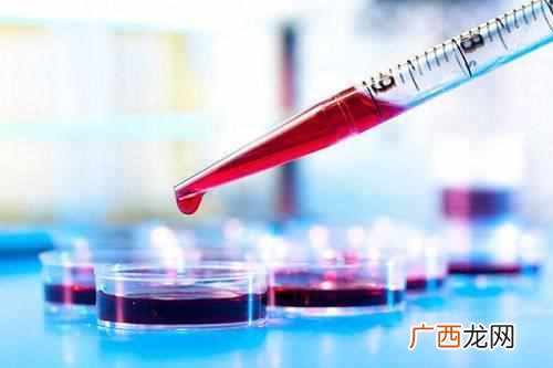 测孕纸怎么看图解?早孕试纸怎么使用?如何准确判断?